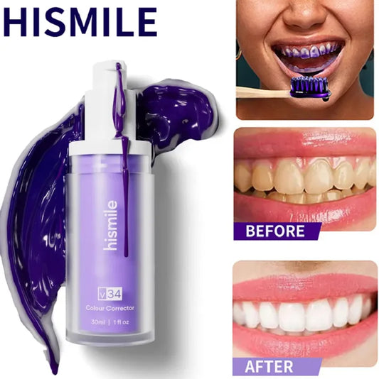 HiSmile V34 Teeth Whitening Serum