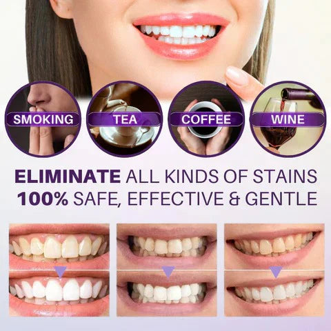 HiSmile V34 Teeth Whitening Serum